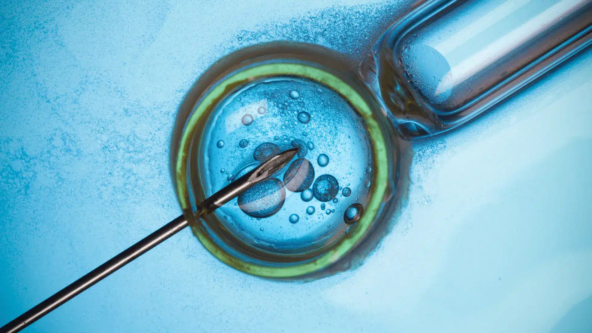 How-to-Improve-Egg-Quality-and-Quantity-for-IVF.png