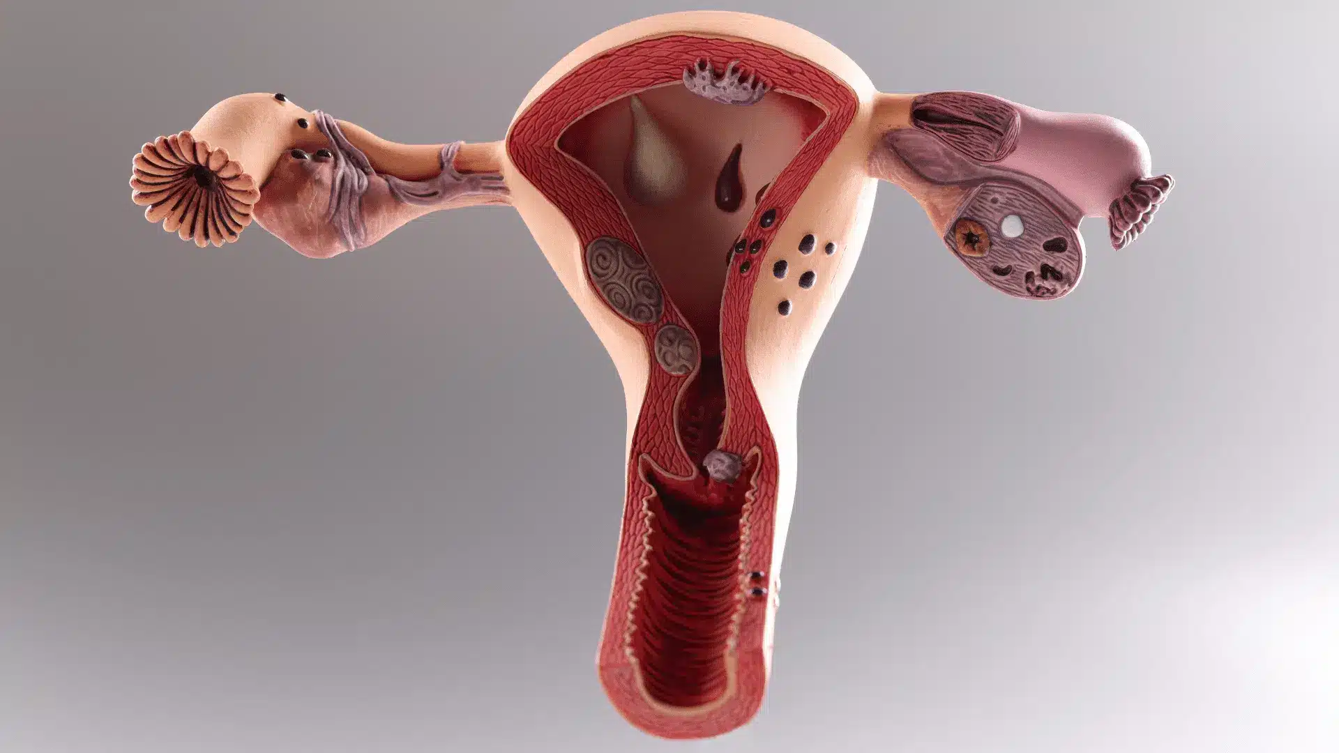 HyCoSy-or-HSG-in-testing-uterine-and-fallopian-tube-health.png
