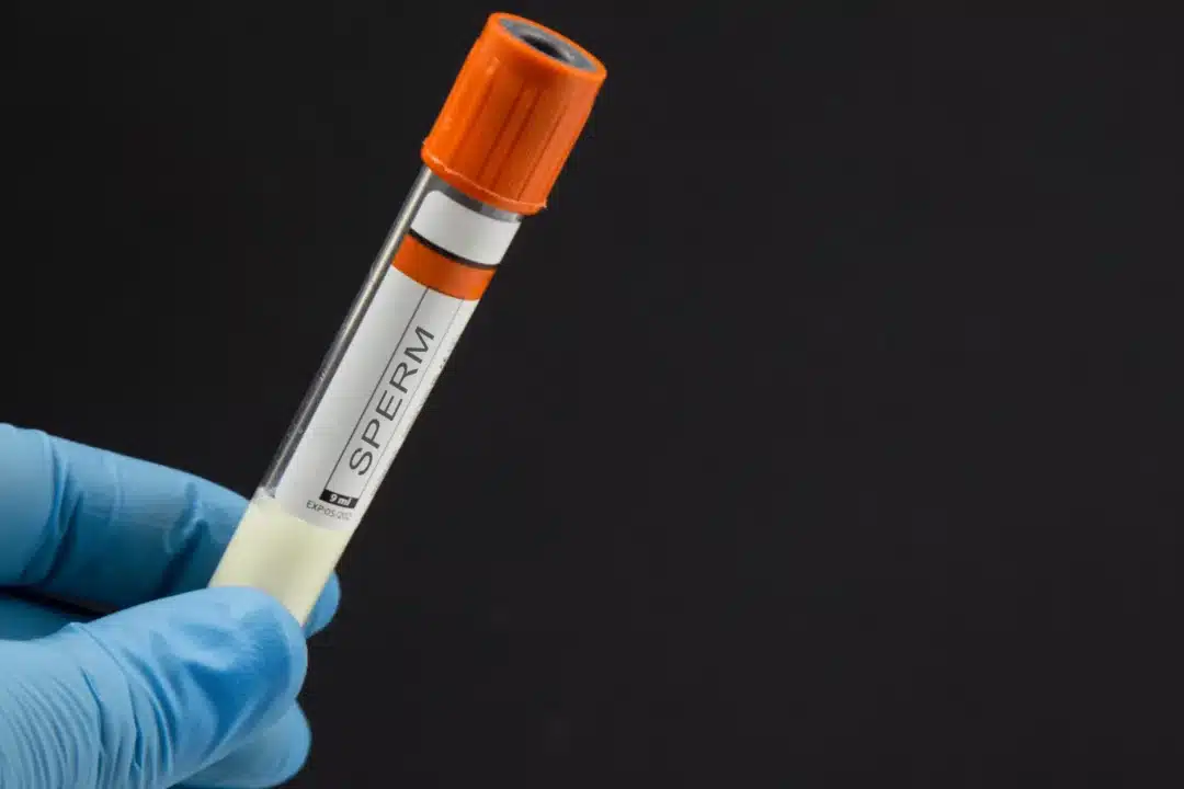 Men Also Have Reasons to Preserve Fertility