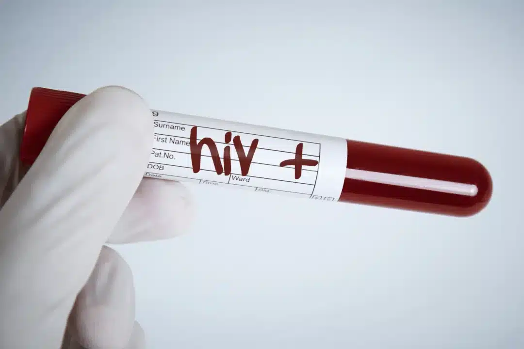 Reproductive support for those living with HIV and AIDS