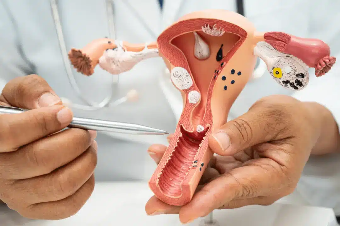 Ways to support a healthy uterine lining