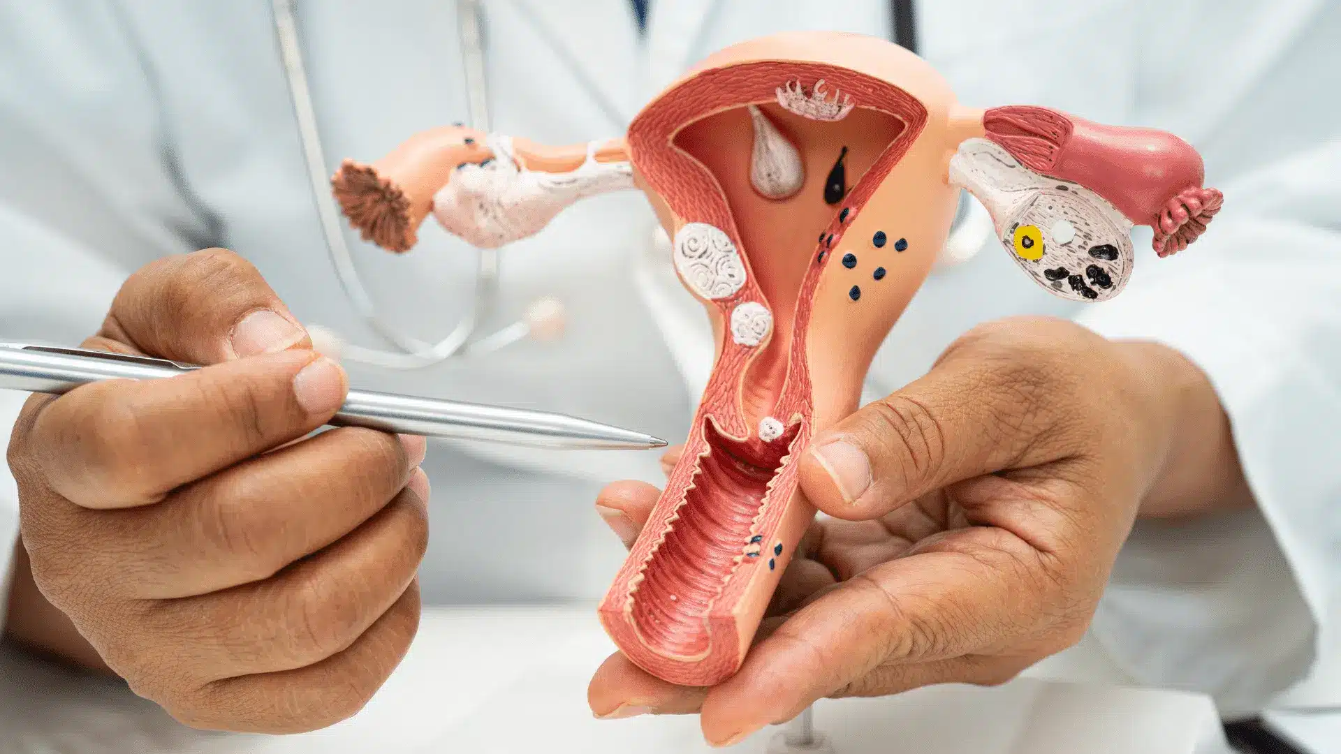 Uterine-Polyps-and-Infertility.png
