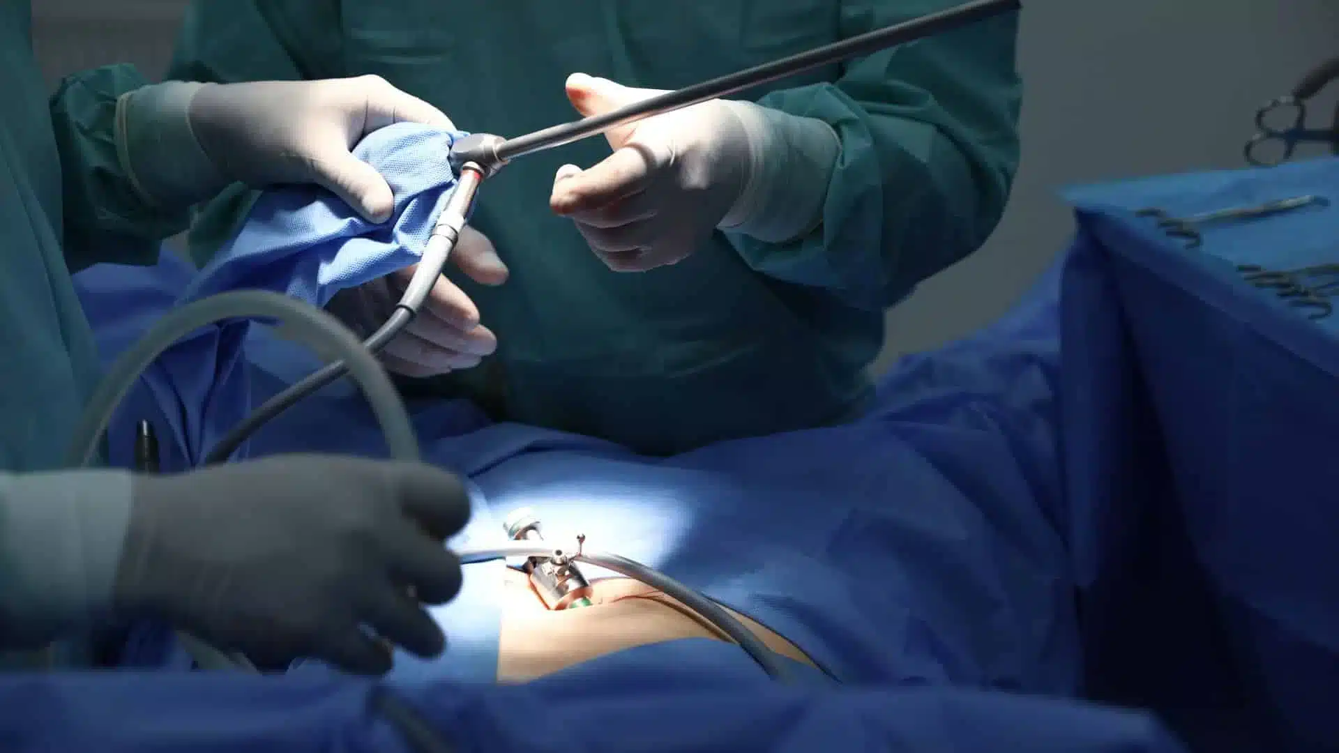 What-are-hysteroscopy-and-laparoscopy_-In-which-cases-these-surgical-procedures-used.jpg