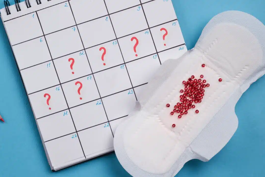 What causes irregular periods?