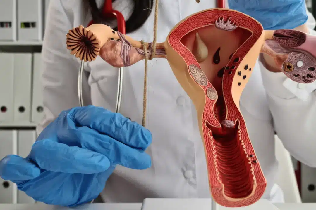 What is Fallopian tube obstruction?