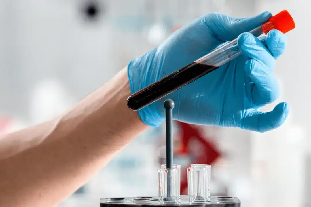 What is an AMH Test?