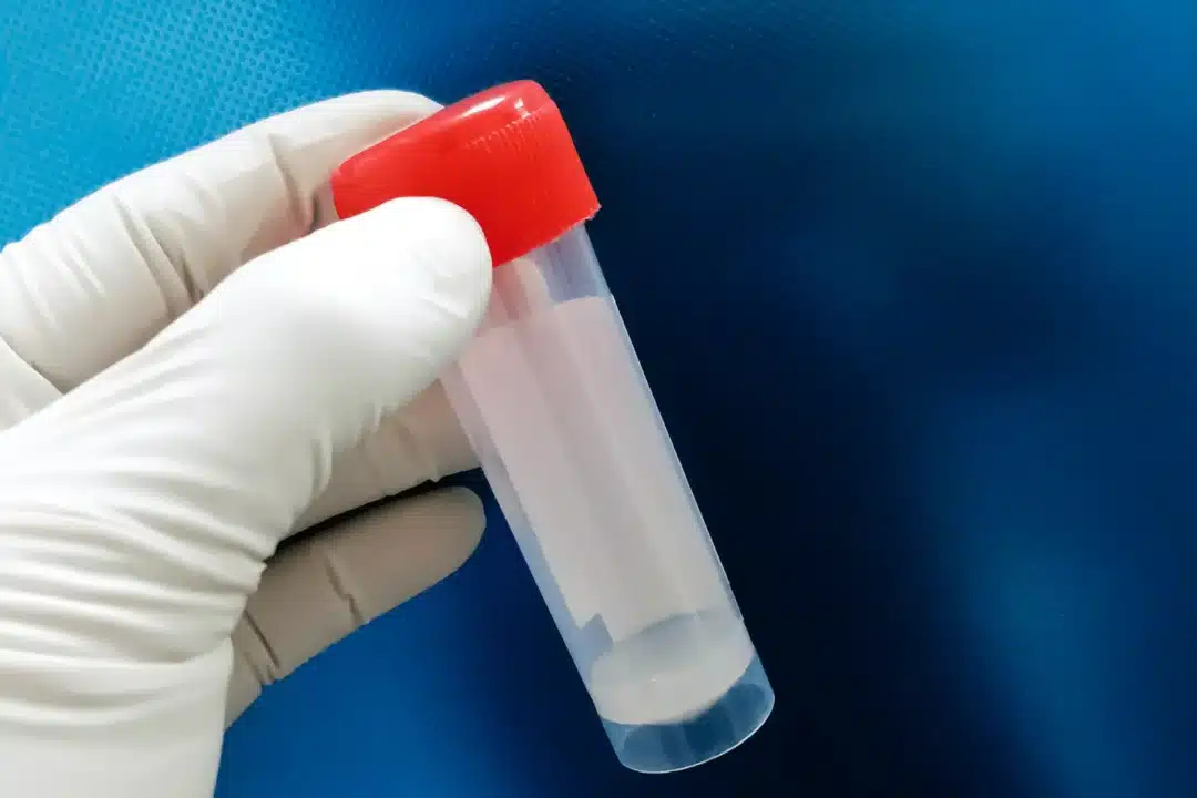 What to expect from semen analysis